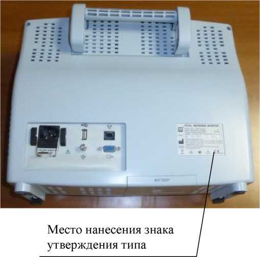Внешний вид. Мониторы медицинские фетальные матери и плода, http://oei-analitika.ru рисунок № 2
