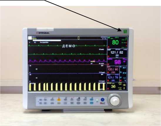 Внешний вид. Мониторы медицинские, http://oei-analitika.ru рисунок № 3