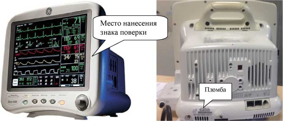 Внешний вид. Мониторы пациента , http://oei-analitika.ru рисунок № 1