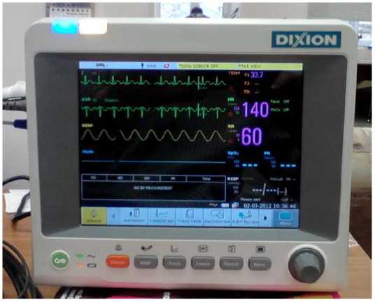 Внешний вид средства измерений: Мониторы пациента , заводской номер №5051809024 