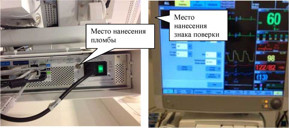 Внешний вид. Мониторы пациента , http://oei-analitika.ru рисунок № 2