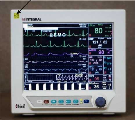 Внешний вид. Мониторы медицинские, http://oei-analitika.ru рисунок № 3