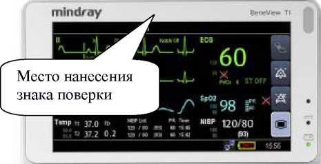 Внешний вид. Мониторы пациента , http://oei-analitika.ru рисунок № 5