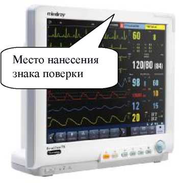 Внешний вид. Мониторы пациента , http://oei-analitika.ru рисунок № 9