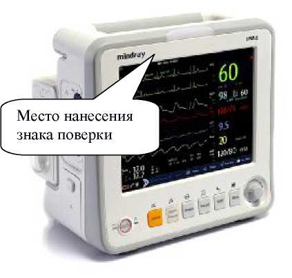 Внешний вид. Мониторы пациента , http://oei-analitika.ru рисунок № 4