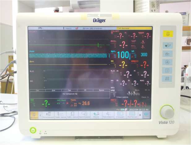 Внешний вид. Мониторы пациента , http://oei-analitika.ru рисунок № 1